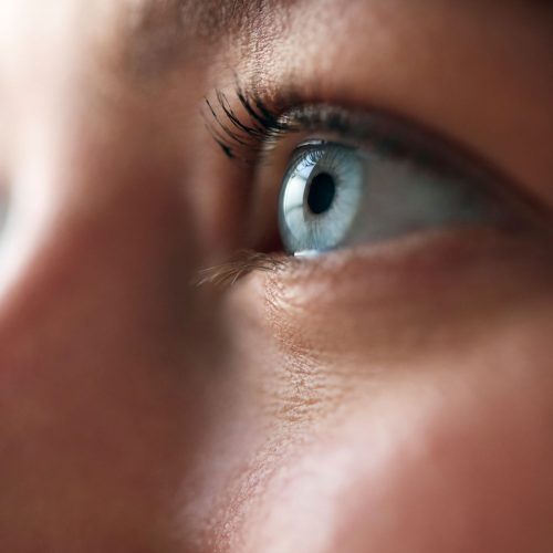 glaucoma
